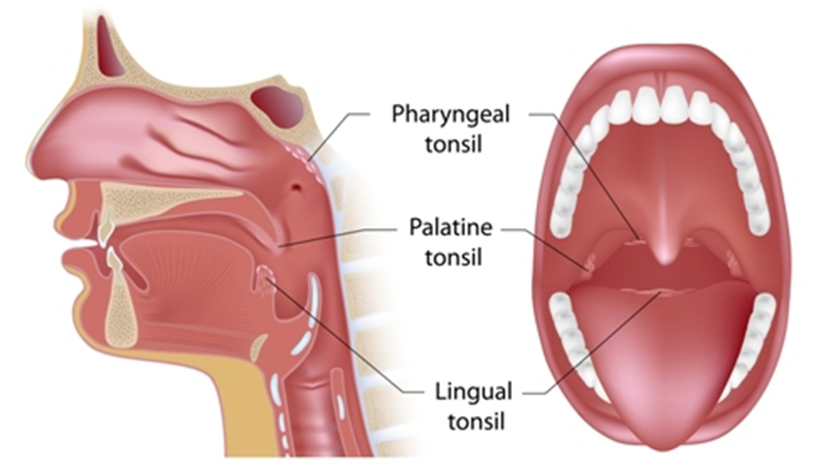 Adenoid