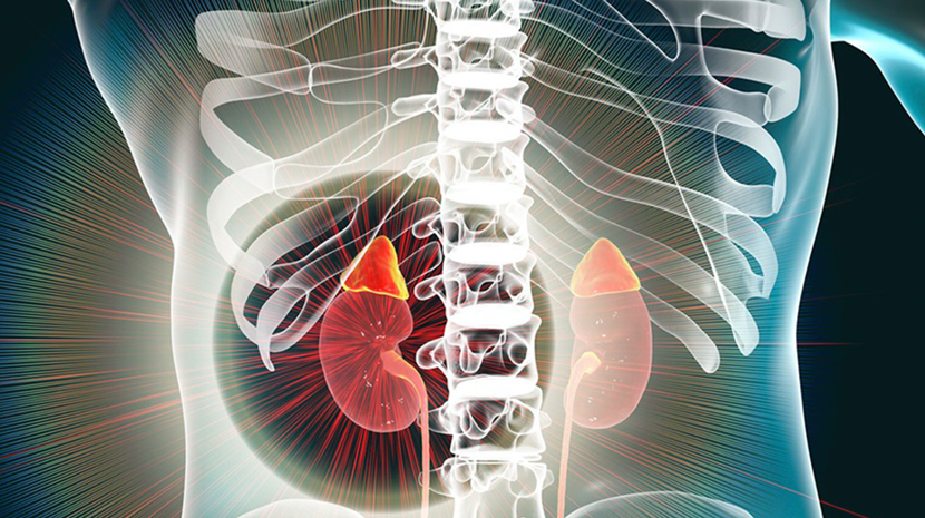 Adrenal Karsinoma